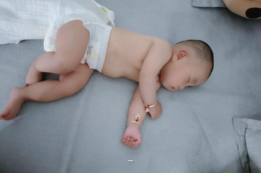 兴安盟宝宝脸上有白色斑块